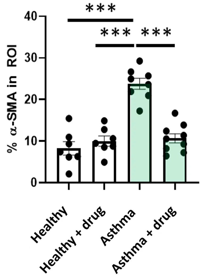 Its effect on… Smooth Muscle